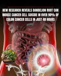 Dandelion root extract (DRE) has shown promising anti-cancer properties 1 FB IMG 1757414512315