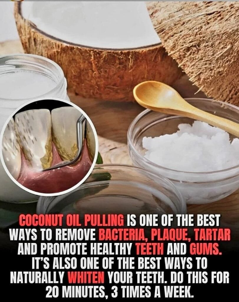 coconut oil pulling as a natural method for improving oral health 1 coconut oil pulling as a natural method for improving oral health