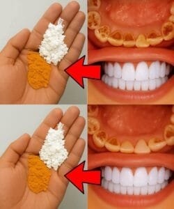 Natural Teeth Whitening: What Works, What Doesn’t, and Safe Alternatives 1 healthy recipes and tips 10
