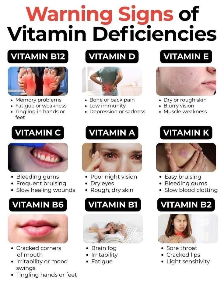 Warning Signs of Vitamin Deficiencies: Symptoms You Shouldn’t Ignore