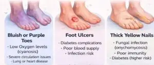 Your Feet Can Reveal More About Your Health Than You Think 4 Foot Cramps