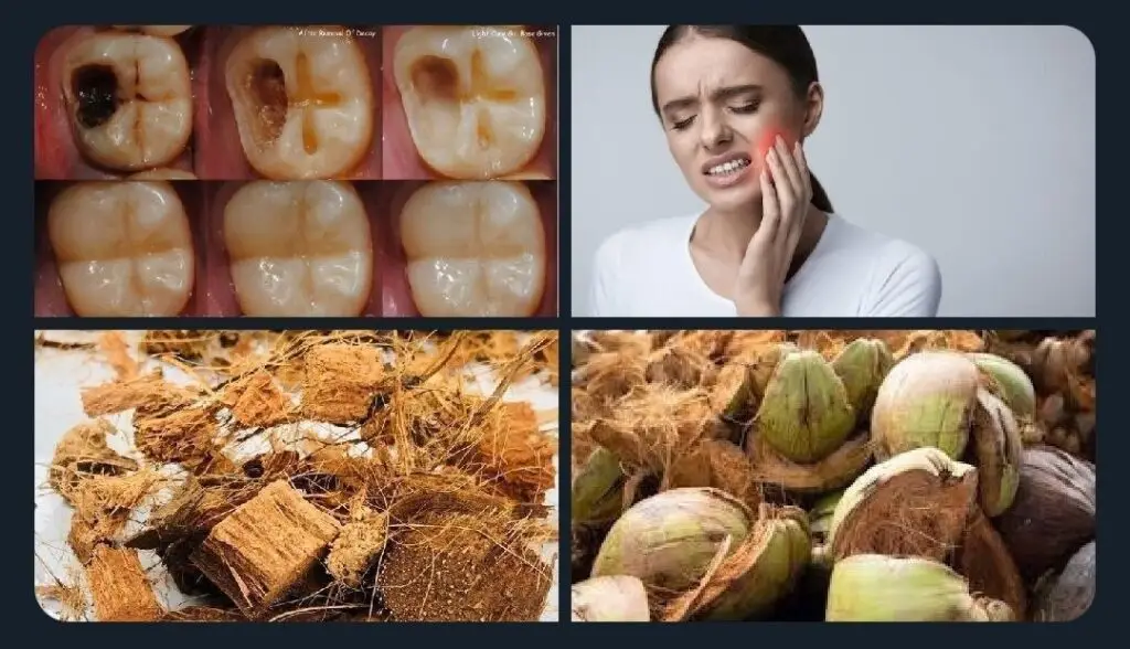 Toothache Relief Simple Home Remedies That Actually Help