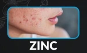 Warning Signs of Mineral Deficiencies1