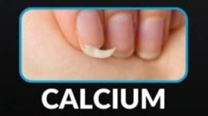 Warning Signs of Mineral Deficiencies9
